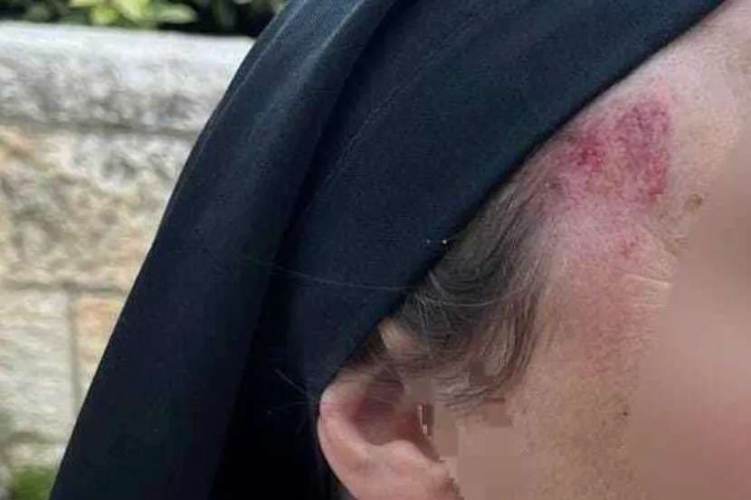 Nun beaten at Jerusalem's Cenacle amid anti-Christian tensions