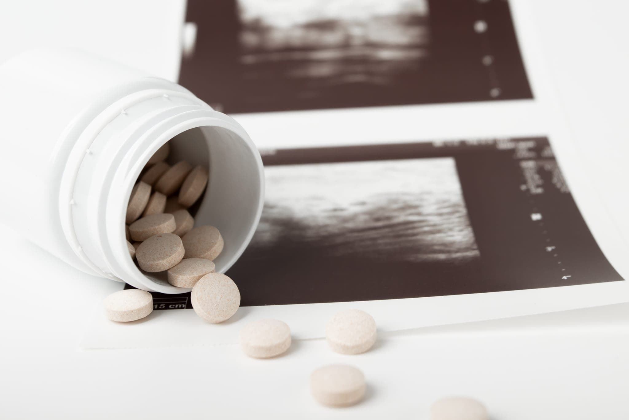 Closing arguments set for Sept. 17 in California AG’s abortion pill reversal suit