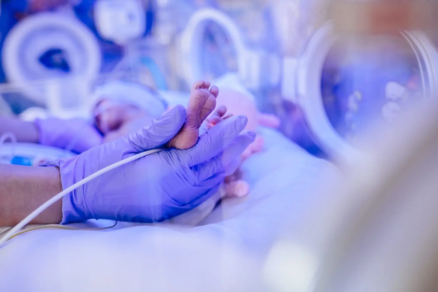 Baby Gabriel undergoes first heart surgery after surrogate mother refused abortion request